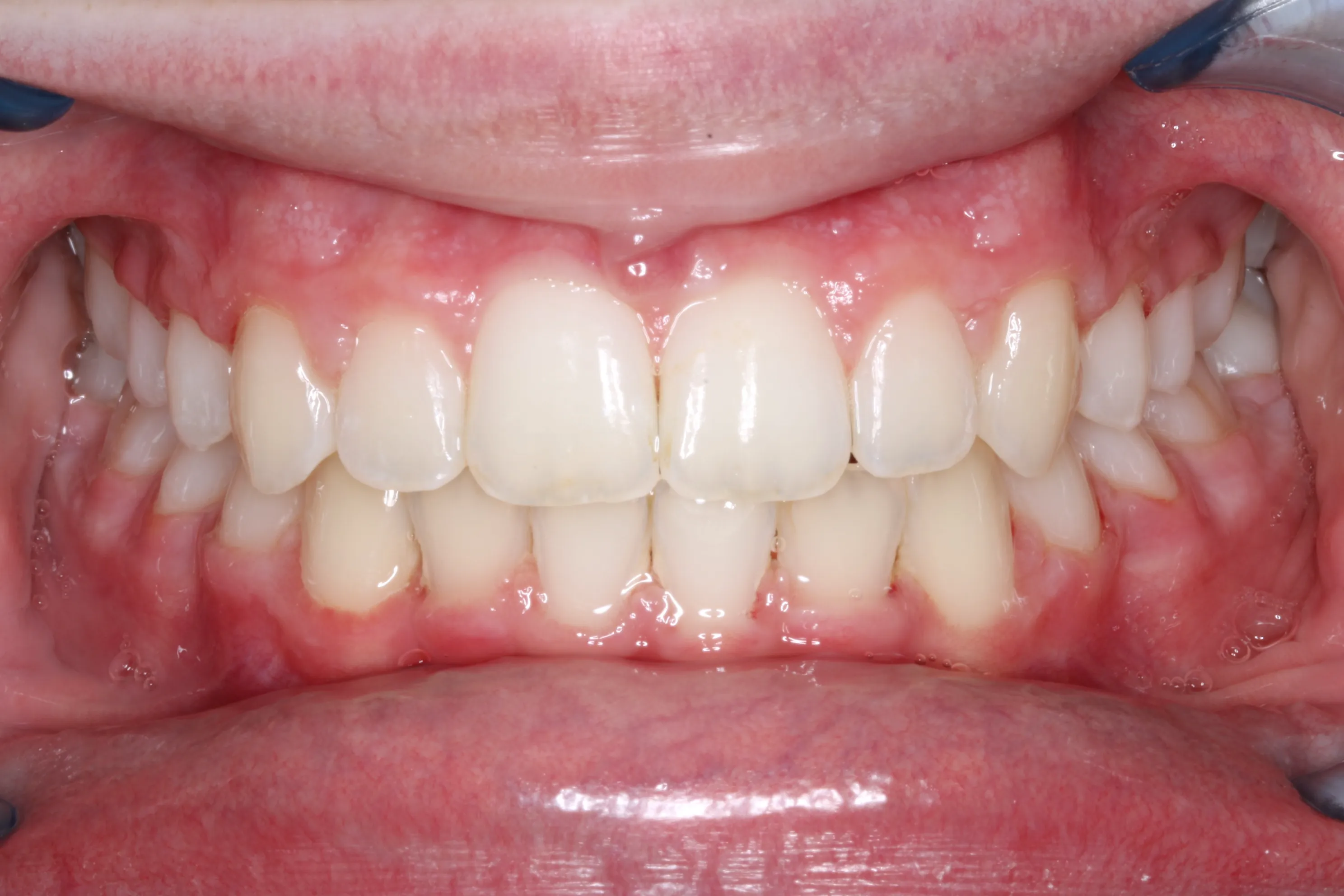 smile-gallery gallery